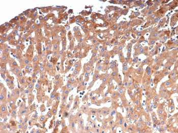 Alpha-2-Macroglobulin Antibody / A2M