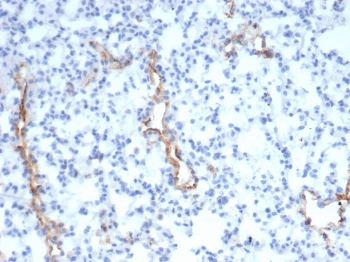 von Willebrand Factor Antibody / vWF