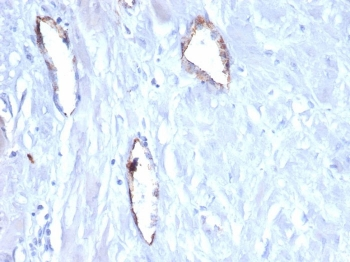 von Willebrand Factor Antibody / vWF