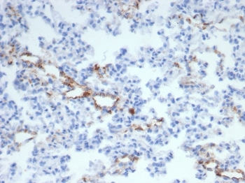 von Willebrand Factor Antibody / vWF