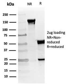 von Willebrand Factor Antibody / vWF