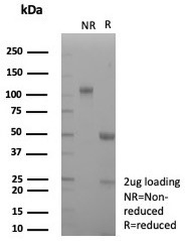 Recombinant CD163 Antibody