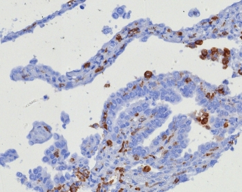 CD163 Antibody