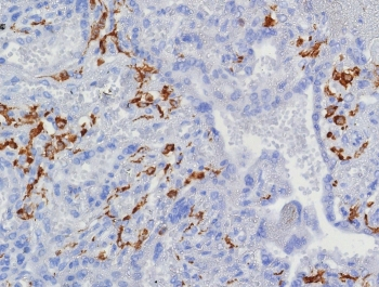 CD163 Antibody