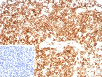 Recombinant CD27 Antibody