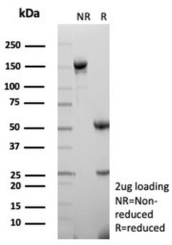 Recombinant CD27 Antibody