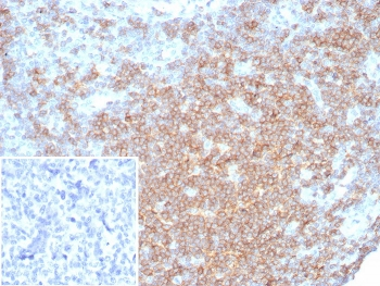 CD27 Antibody