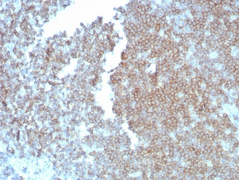 CD27 Antibody