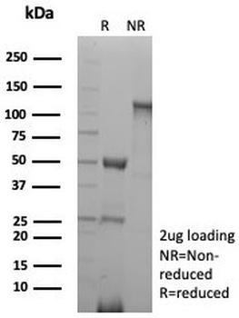 CD27 Antibody
