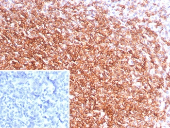 CXCR5 Antibody / CD185 / BLR1 / MDR15