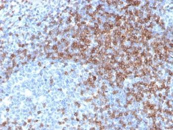 CD3 epsilon Antibody
