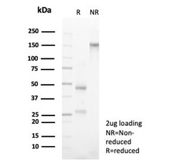CD3 epsilon Antibody
