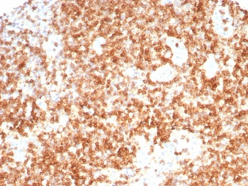 CD3 gamma Antibody