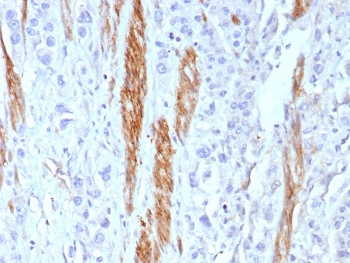 NCAM Antibody / CD56