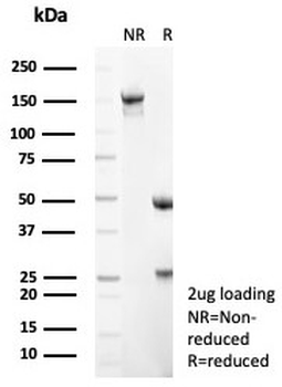 Recombinant CD56 Antibody