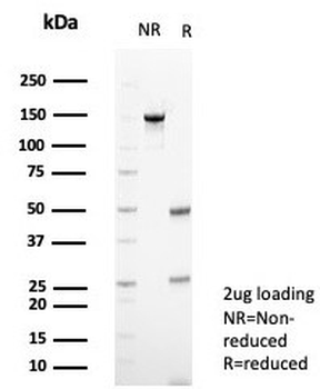 CD56 Antibody