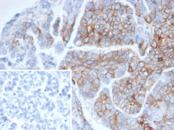 CD56 Antibody / NCAM