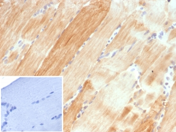 Crystallin Alpha B Antibody