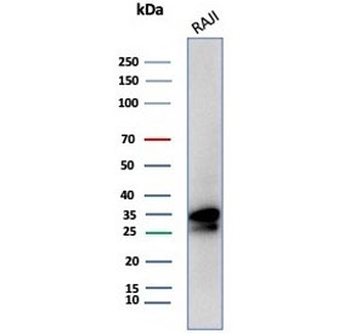 Recombinant CD20 Antibody