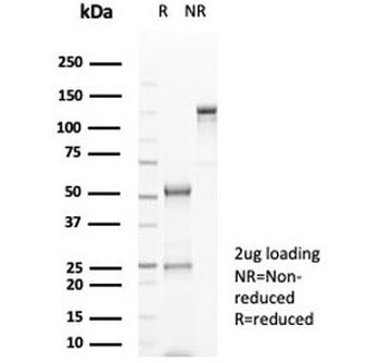 Recombinant CD20 Antibody