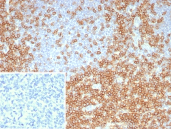 Recombinant CD5 Antibody