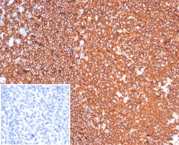 CD20 Antibody