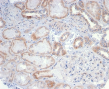 CD20 Antibody