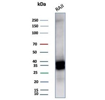 CD20 Antibody