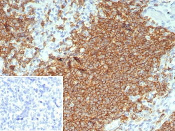 CD20 Antibody