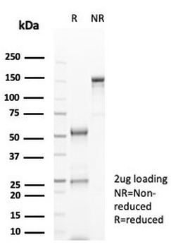 CD20 Antibody
