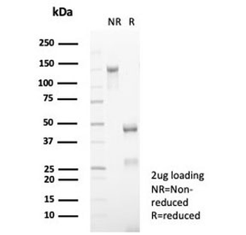 CD5 Antibody