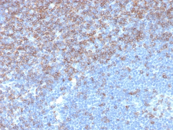 CD5 Antibody