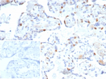 p57Kip2 Antibody