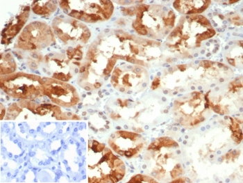 Crystallin Alpha B Antibody