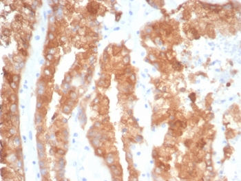 Crystallin Alpha B Antibody