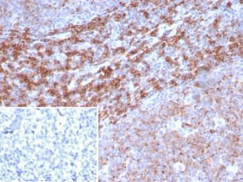 CD39 Antibody