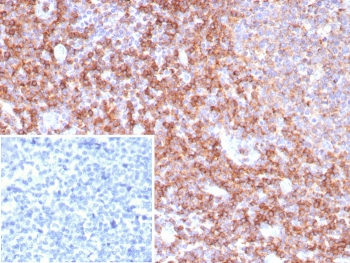 CD39 Antibody