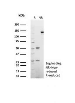 CD39 Antibody