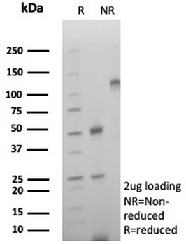 CD39 Antibody
