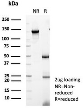 RBP4 Antibody / Retinol Binding Protein 4