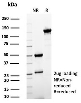 SFTPD Antibody / Surfactant protein D