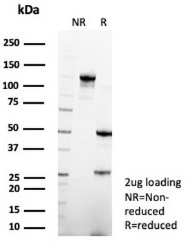 Surfactant protein D Antibody