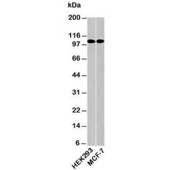 LSD1 Antibody / Lysine-Specific Demethylase 1