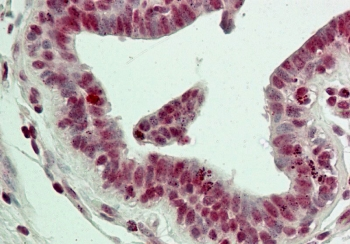 LSD1 Antibody / Lysine-Specific Demethylase 1