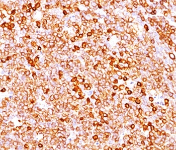 CD79a Antibody Cocktail