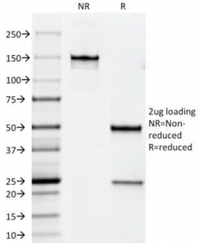 ErbB2 Antibody / HER2