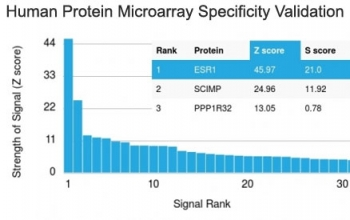 ER Antibody / Estrogen Receptor alpha