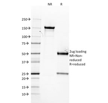 ER Antibody / Estrogen Receptor alpha