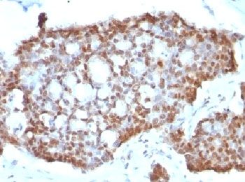 Estrogen Receptor beta Antibody