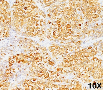 Melan-A Antibody